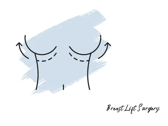 Best Breast Lift Surgeon  in Gachibowli