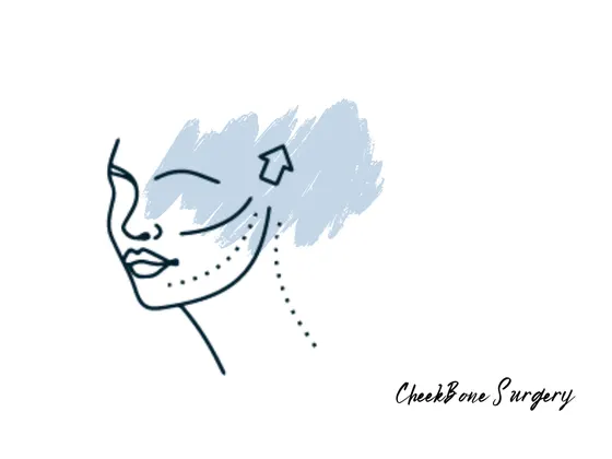 Cheekbone Surgeon Best Cheekbone Surgeon in Gachibowli