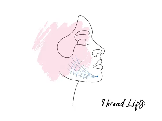 Best Thread Lifts Surgeon Best Thread Lifts Surgeon in Gachibowli