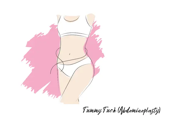 Abdominoplasty Surgeon tummy-tuck treatment in gachibowli